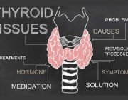 thyroid-issues thyroid-issues