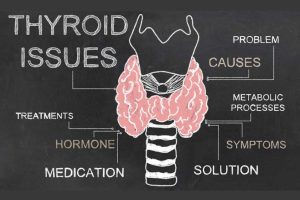 thyroid-issues