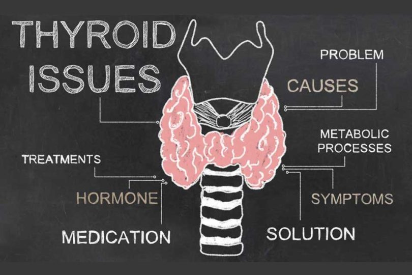 thyroid-issues thyroid-issues