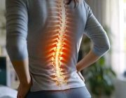 scoliosis scoliosis
