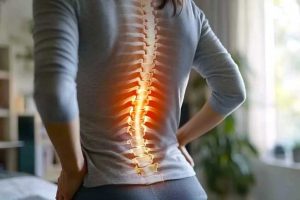 scoliosis